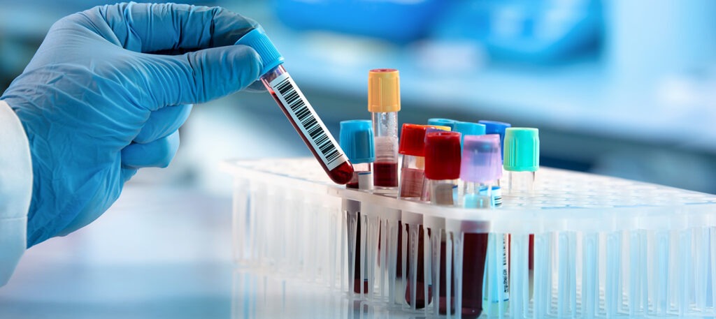 Hormone testing - Embryo Clinic